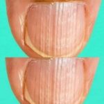 Having Striped Nails Could Mean That Your Body Is…- Here’s What It Is