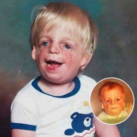 When Jono’s mother first saw his face, she ran away and left him in the maternity crib. But what this ”monster” looks like today, 30 years later, is truly amazing.