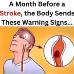 Attention… A Month Before a Stroke