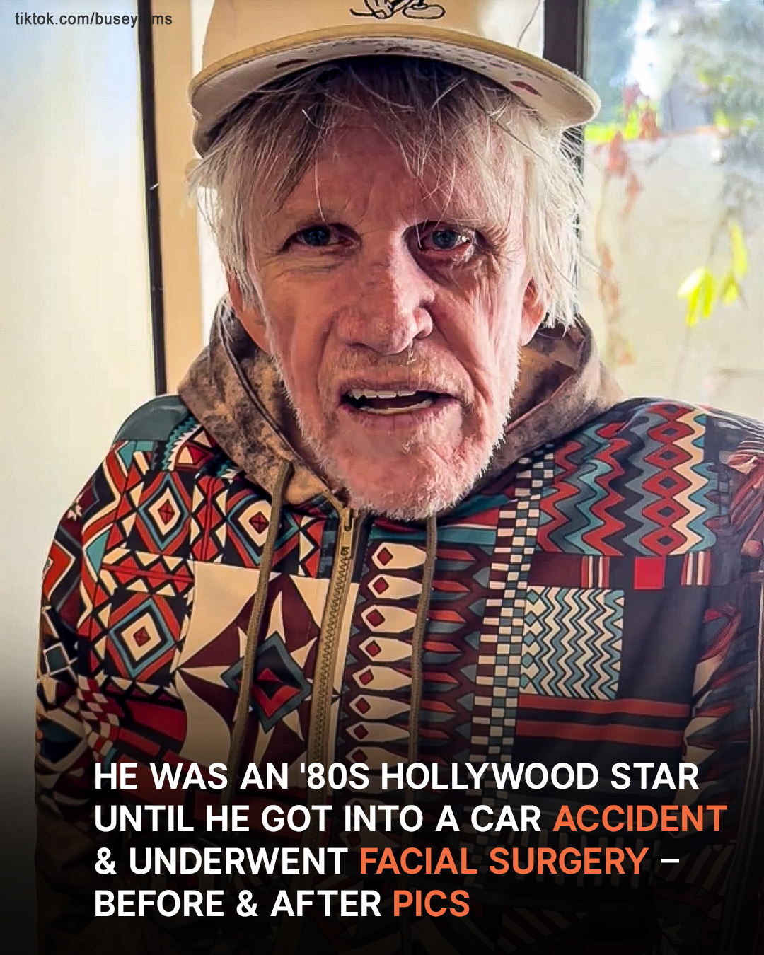 He Was A Hollywood Star In The ’80s, But Then Survived A Terrible Road Accident & Underwent Facial Surgery – His Pics At 80